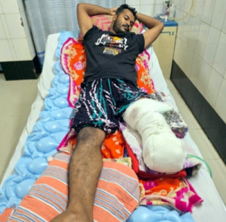 দুর্ঘটনায় যুবকের পা হারাল, হাসপাতালে বাবা–ছেলে চিকিৎসাধীন