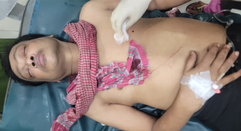 খুলনায় দুর্বৃত্তের গুলিতে আহত    ১