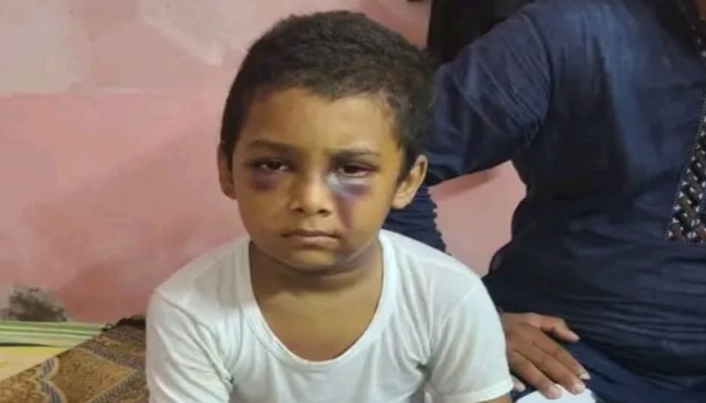১১ দিন পার হলেও গ্রেফতার হয়নি মাদ্রাসা শিক্ষক    মাথার ফোলা না কমায় শঙ্কায় নির্যাতিত শিশু ইসমাইলের পরিবার