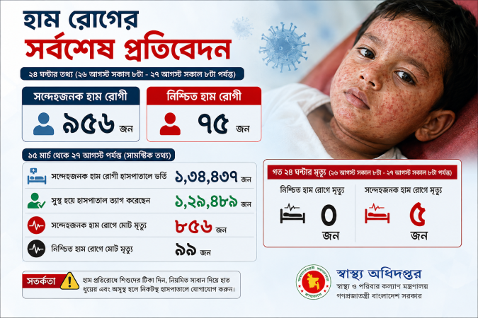 ২৪ ঘণ্টায় ৯৫৬ সন্দেহজনক হাম রোগী, নিশ্চিত শনাক্ত ৭৫