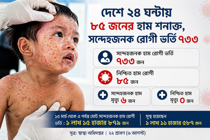 দেশে ২৪ ঘণ্টায় ৮৫ জনের হাম শনাক্ত, সন্দেহজনক রোগী ভর্তি ৭৩৩